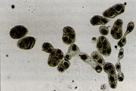 Fungal protoplasts
